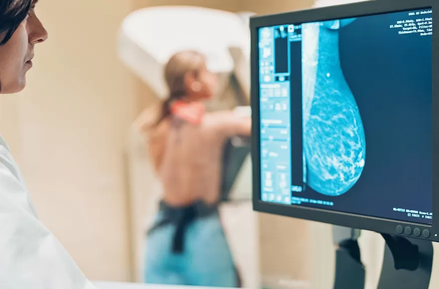 Mamografías en Berisso: cómo sacar turno